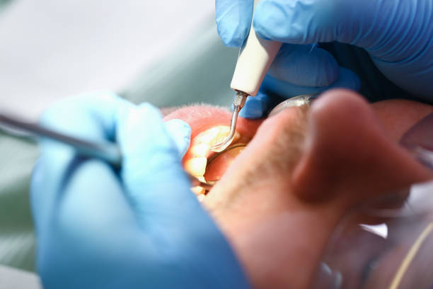 Best Walk-In Emergency Dental Services in Camp Hill, AL