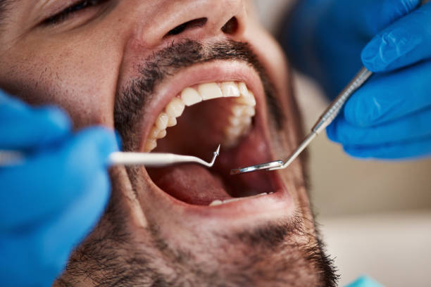 Best Emergency Root Canal Therapy in Camp Hill, AL